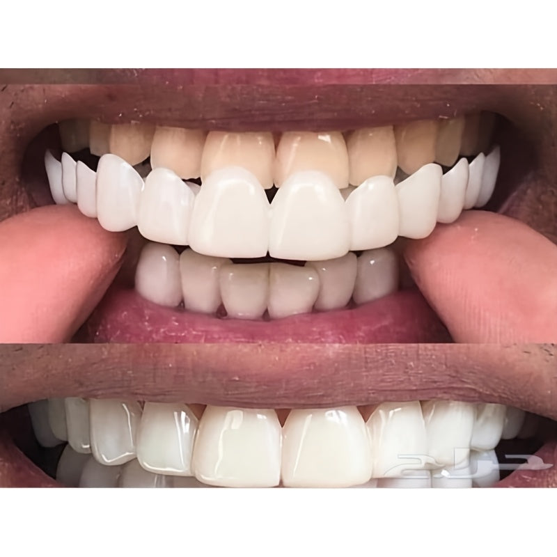 4-Piece Dental Set | Flexible Disposable Dentures | Includes Storage Box